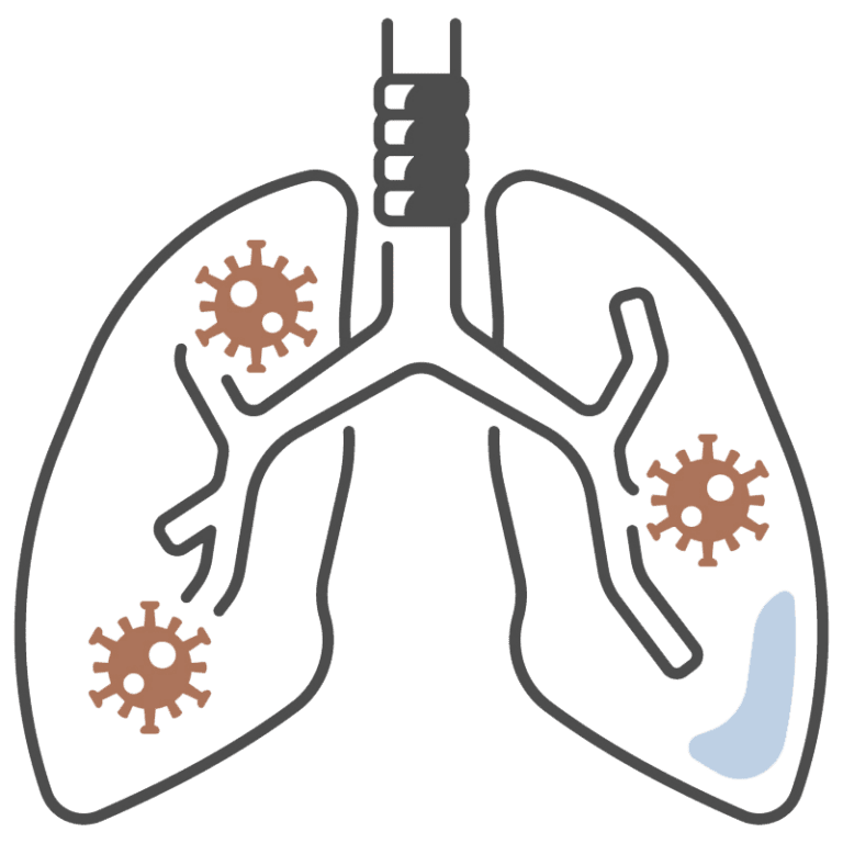 Infected lungs